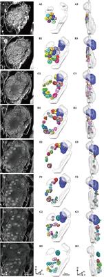 Anatomical Comparison of Antennal Lobes in Two Sibling Ectropis Moths: Emphasis on the Macroglomerular Complex